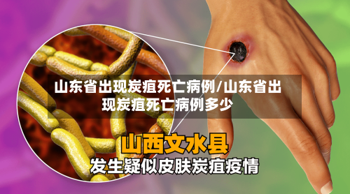 山东省出现炭疽死亡病例/山东省出现炭疽死亡病例多少-第2张图片
